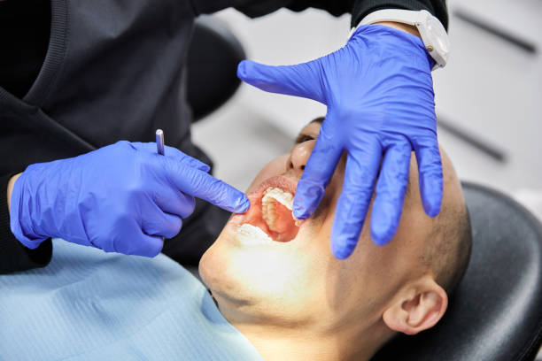 Best Emergency Tooth Extraction in Oak Valley, NJ